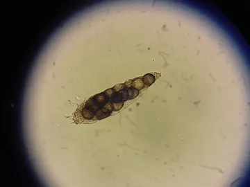 Demodex folliculorum Demodex folliculorum