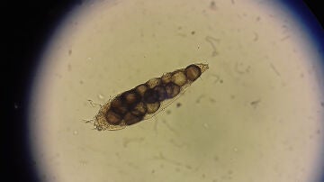 Demodex folliculorum
