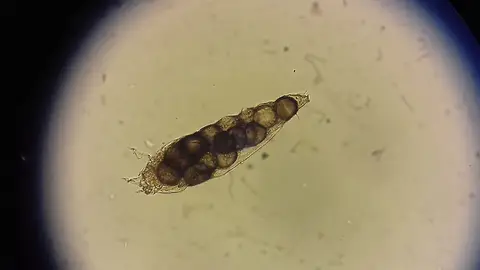 Demodex folliculorum Demodex folliculorum