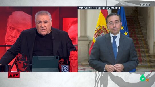Albares, sobre Vox