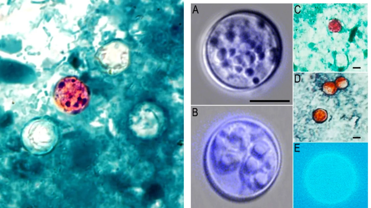 Qué es la Cyclospora, un parásito que provoca diarrea causa de un brote en medio Estados Unidos Qué es la Cyclospora, un parásito que provoca diarrea causa de un brote en medio Estados Unidos