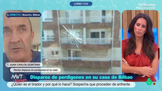 Perdigones Basurto corto