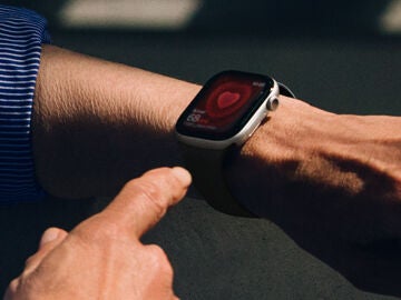 Apple Watch series 11