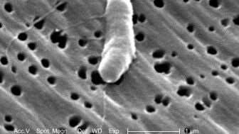 Un brote de 'bacteria carn&iacute;vora' mata a 5 personas en EEUU, en alerta por la ola de ciclosporiasis