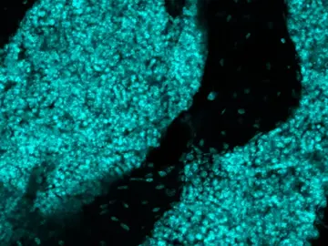 Las estructuras recientemente descubiertas en la médula ósea del cráneo Las estructuras recientemente descubiertas en la médula ósea del cráneo
