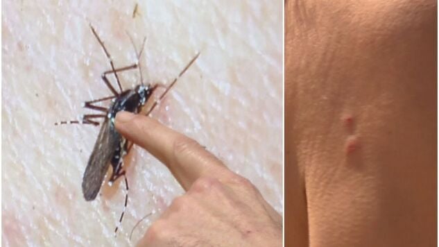 A la izquierda, un mosquito; a la derecha, una picadura
