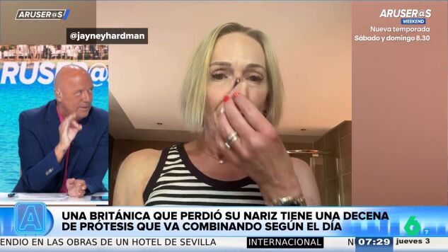 Alfonso Ar&uacute;s, tras conocer a la mujer con diez narices intercambiables: "Esto para Lucas es perfecto"