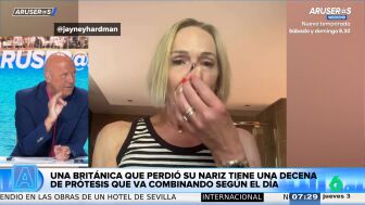 Alfonso Ar&uacute;s, tras conocer a la mujer con diez narices intercambiables: "Esto para Lucas es perfecto"