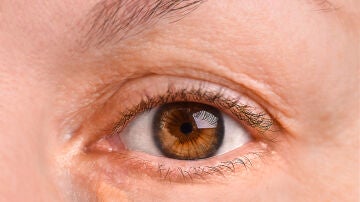 Ojo de una mujer con xantelasma