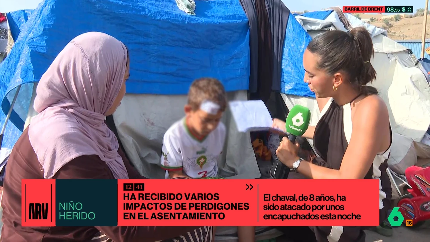 Varios encapuchados hieren a un niño migrante en la cabeza tras dispararle con perdigones en el asentamiento de El Príncipe, en Ceuta Varios encapuchados hieren a un niño migrante en la cabeza tras dispararle con perdigones en el asentamiento de El Príncipe, en Ceuta