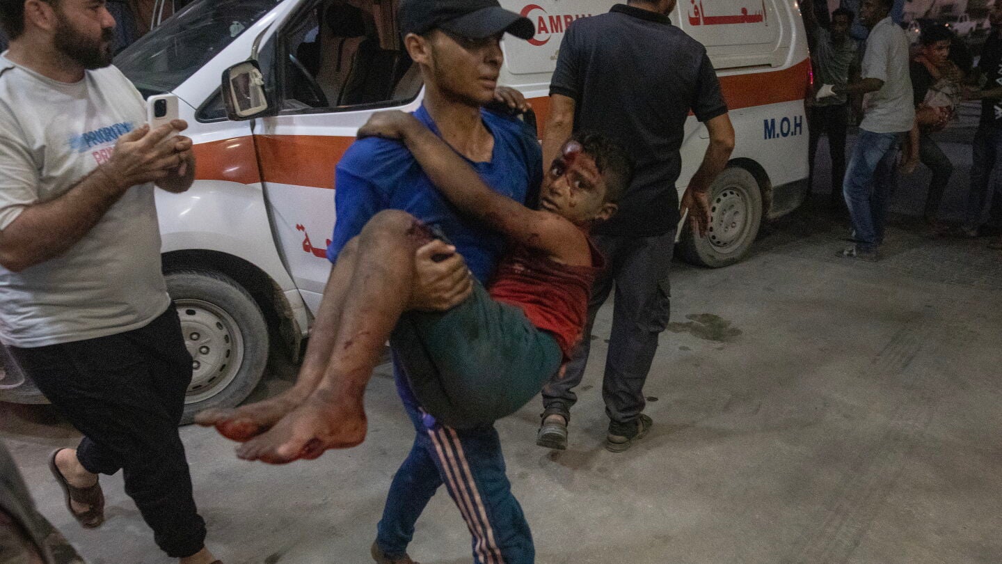 Un ni&ntilde;o herido tras un ataque israel&iacute; en Gaza