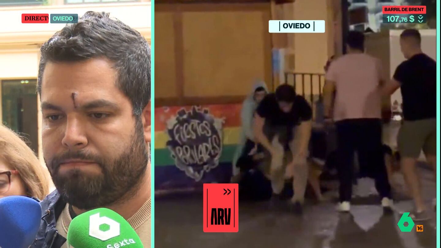 Rub&eacute;n, v&iacute;ctima de la agresi&oacute;n fascista en Oviedo, acusa a Feij&oacute;o de "esconderse" tras las palabras del alcalde: "&iquest;No hay nadie en el PP al que le parezca mal que nos pateen la cara?"