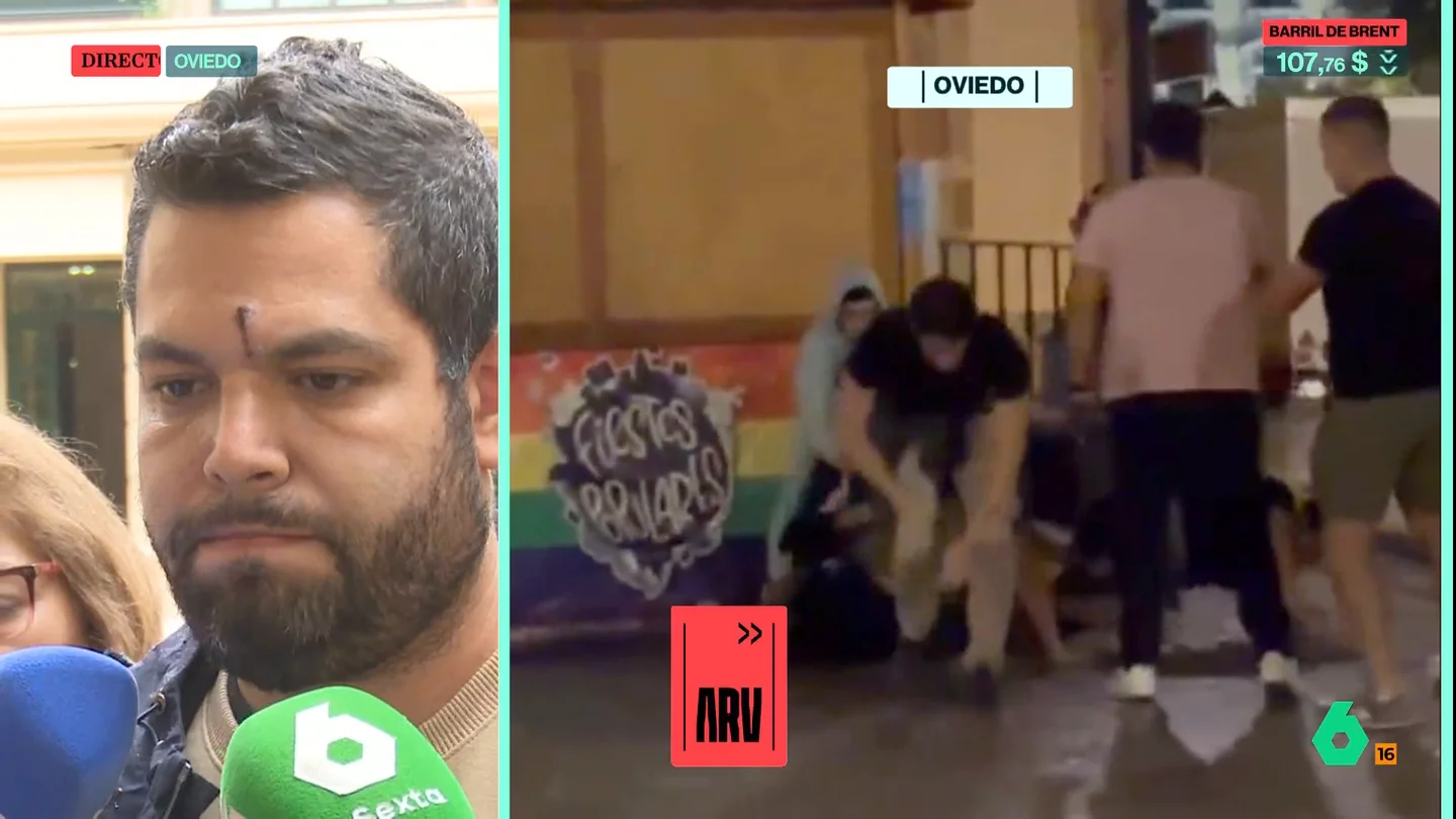 Rubén, víctima de la agresión fascista en Oviedo, acusa a Feijóo de "esconderse" tras las palabras del alcalde: "¿No hay nadie en el PP al que le parezca mal que nos pateen la cara?" Rubén, víctima de la agresión fascista en Oviedo, acusa a Feijóo de "esconderse" tras las palabras del alcalde: "¿No hay nadie en el PP al que le parezca mal que nos pateen la cara?"