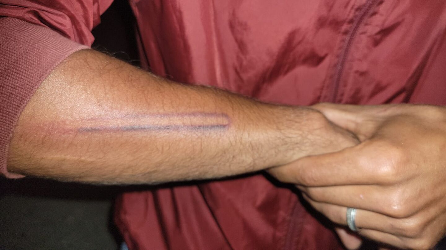 Noche de altercados y peleas en la playa de El Trampol&iacute;n