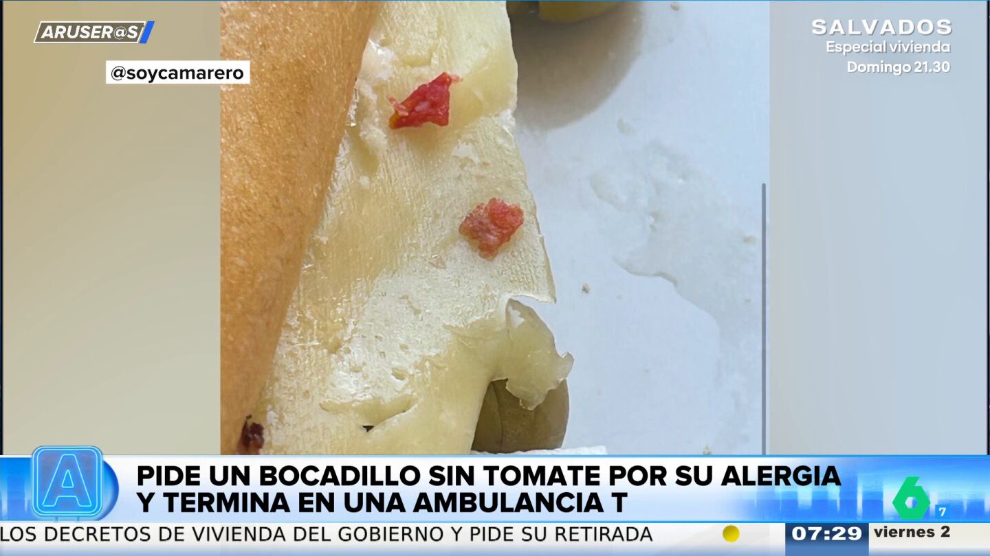 Una chica pide un bocata de lomo sin tomate por su alergia y acaba en una ambulancia: "Esto es peligros&iacute;simo"