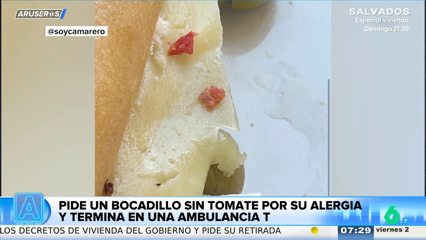 Una chica pide un bocata de lomo sin tomate por su alergia y acaba en una ambulancia: "Esto es peligrosísimo" Una chica pide un bocata de lomo sin tomate por su alergia y acaba en una ambulancia: "Esto es peligrosísimo"